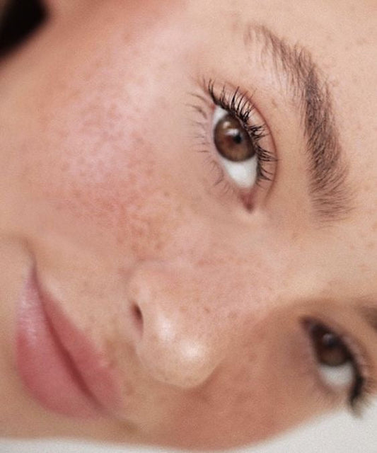 грижа за младежката кожа, цялостна рутина, продукти против акне, пъпки, вироки пори и раздразнения